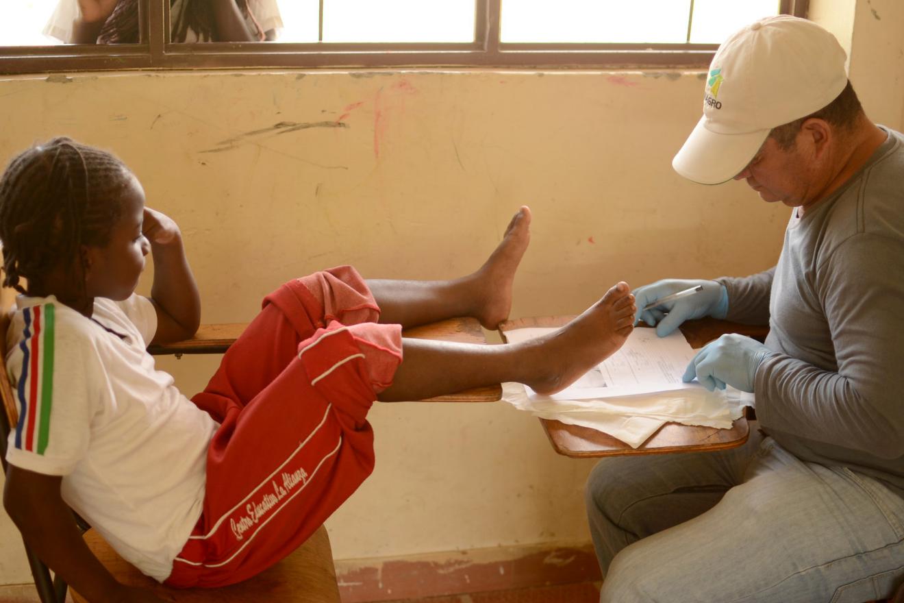 Los pies de una niña son evaluados de tungiasis.
